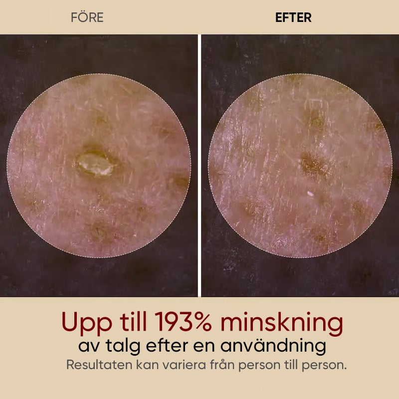 Sale - Mild Peelingampull