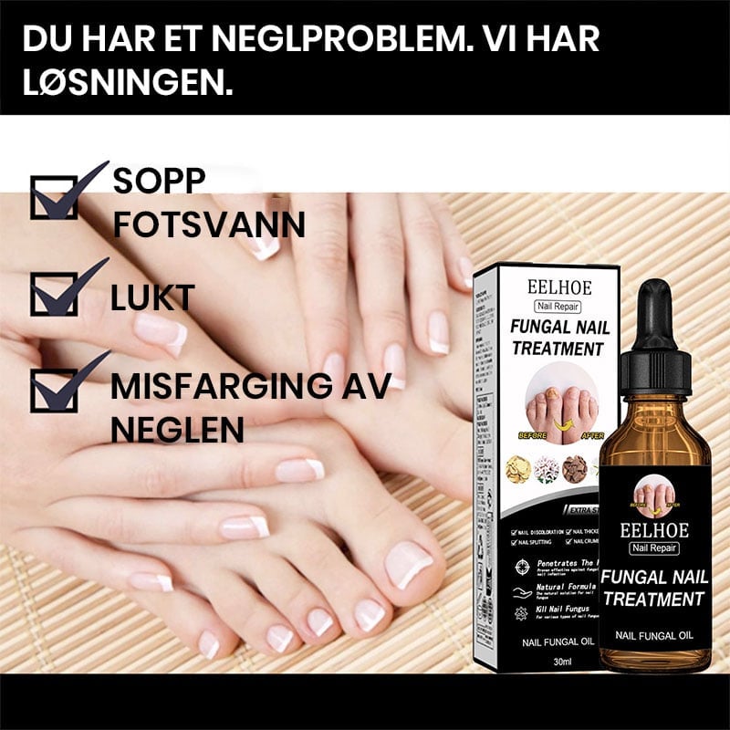 Løsning for Neglefornyelse