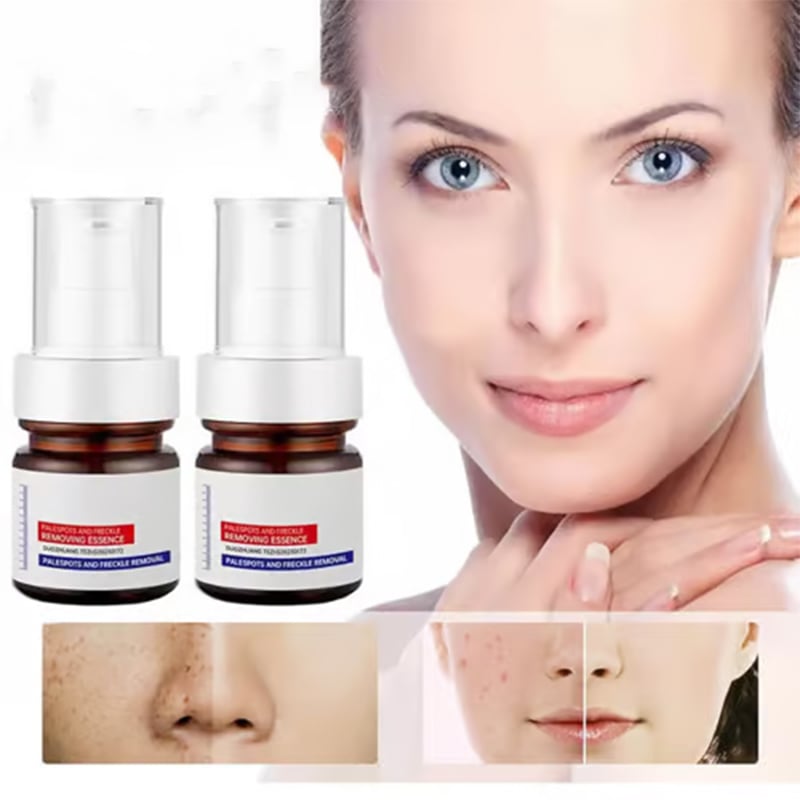 Vitamin C Whitening Freckles Face Cream