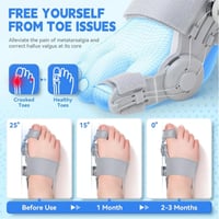 Upgraded Bunion Corrector