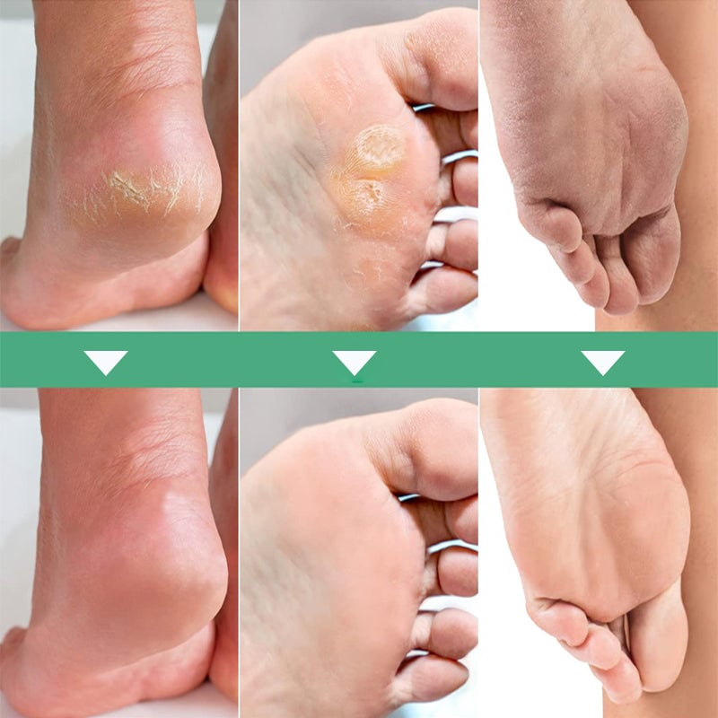 Exfolierande Fotmask