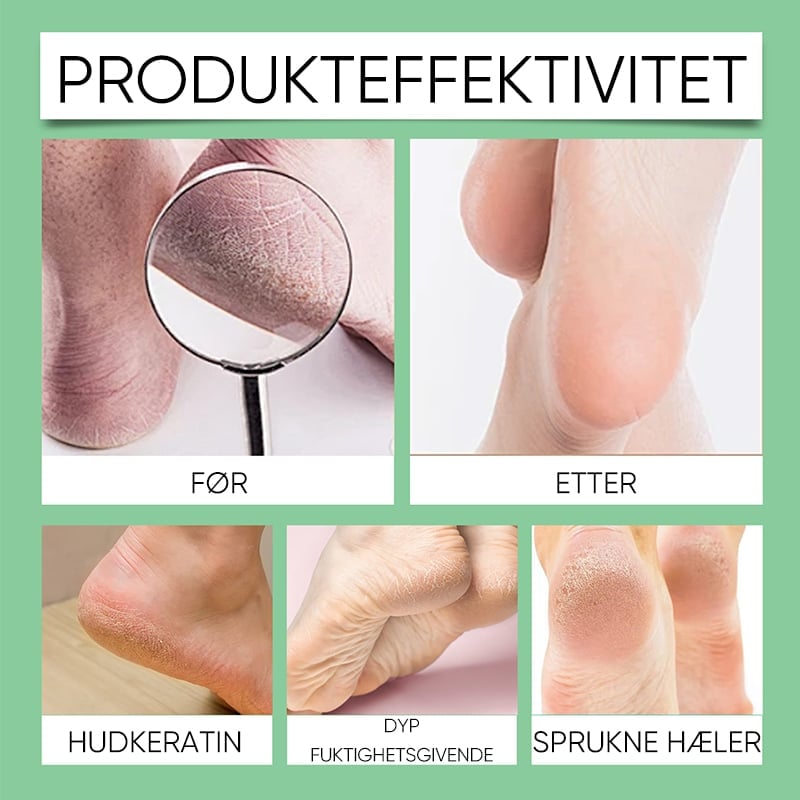 Fotkallus Fjerner