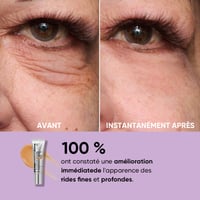 Tenseur temporaire pour les yeux