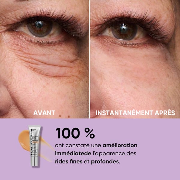 Tenseur temporaire pour les yeux