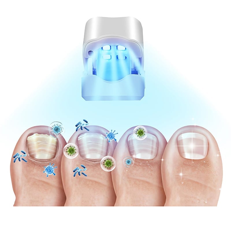 Tragbares UV-Mini-Phototherapiegerät