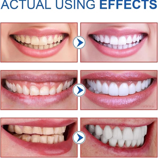 SP10 Probiotic Toothpaste