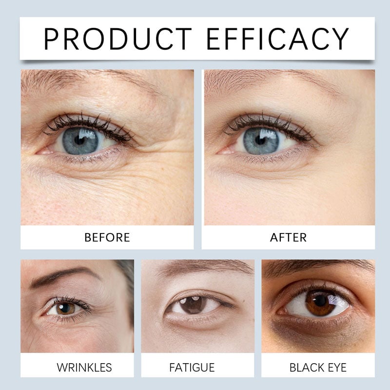 Moisturizing & Rapid Reduction Eye Serum - Packaging upgrade