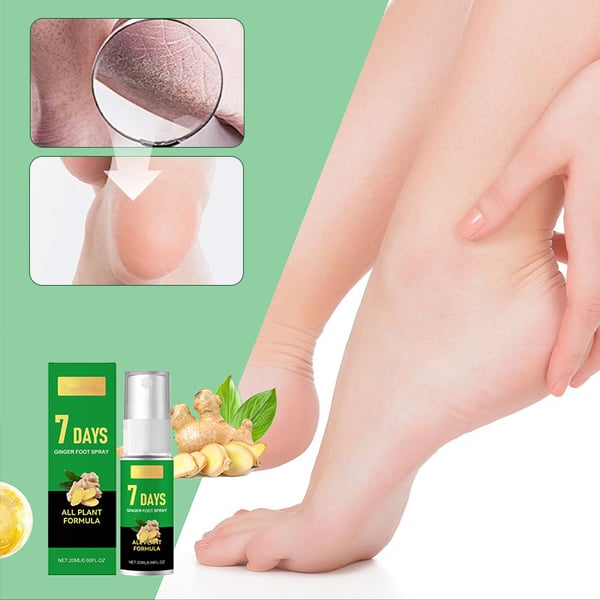 Feet Callus Remover