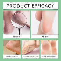 Feet Callus Remover