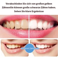 SP-6 Zahnpasta Whitening