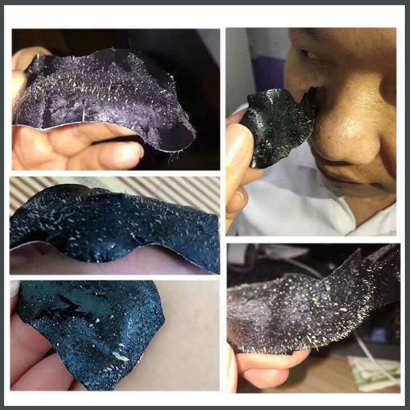 Deep-Cleansing Blackhead Nose Strips