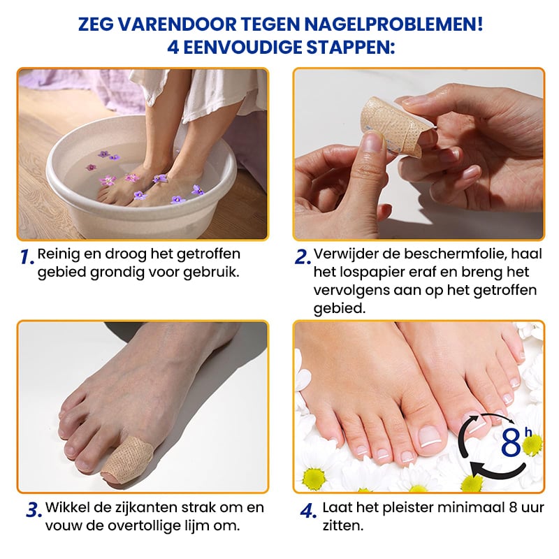 Schimmelnagelplekken