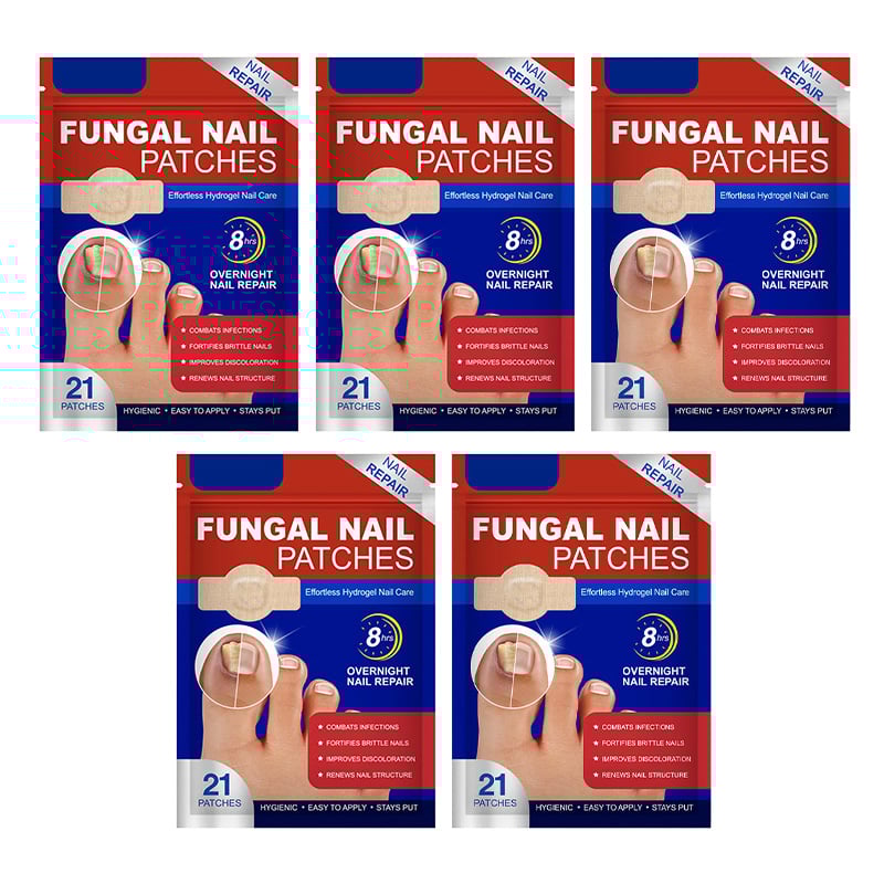 Schimmelnagelplekken