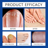 Nail Care Light