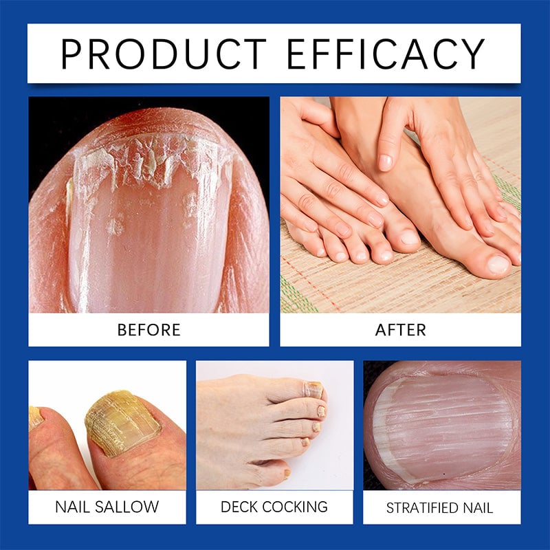 Nail Care Light
