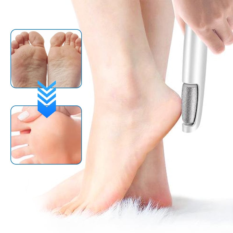 Sale - Electric Feet Callus Remover