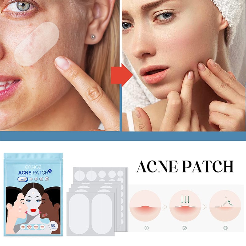 💕Acne Patches💕