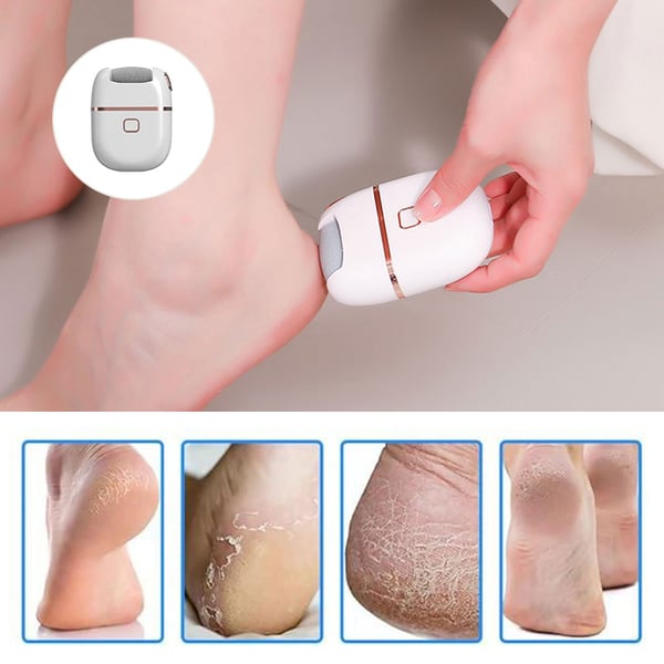 Portable Electric Foot Exfoliator