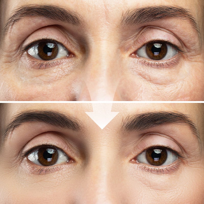 Electric Massage Eye Cream for Dark Circle