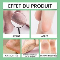 Exfoliant pour callosités des pieds