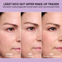 Temporärer Augenstraffer