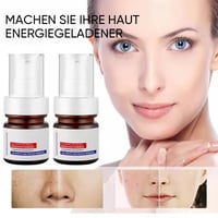 Aufhellende Gesichtscreme gegen Sommersprossen mit Vitamin C