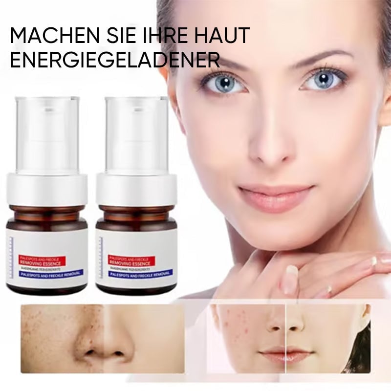Aufhellende Gesichtscreme gegen Sommersprossen mit Vitamin C