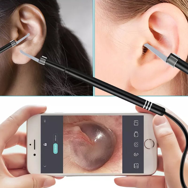 Luminescent Smart Earwax Removal Endoscope