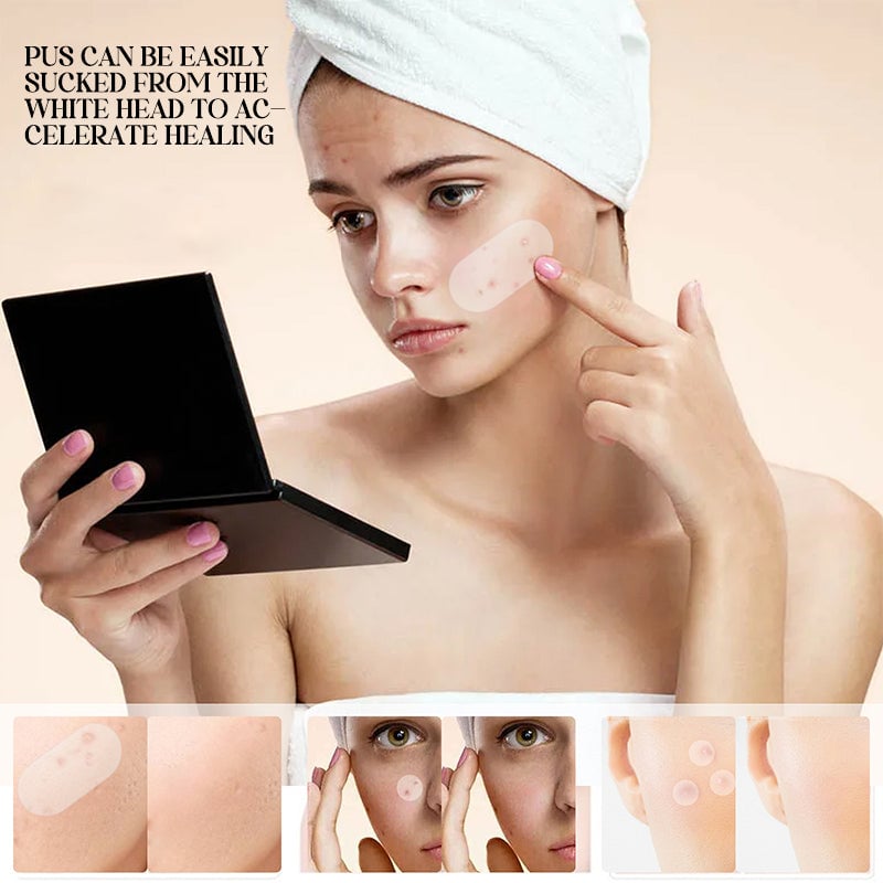 💕Acne Patches💕