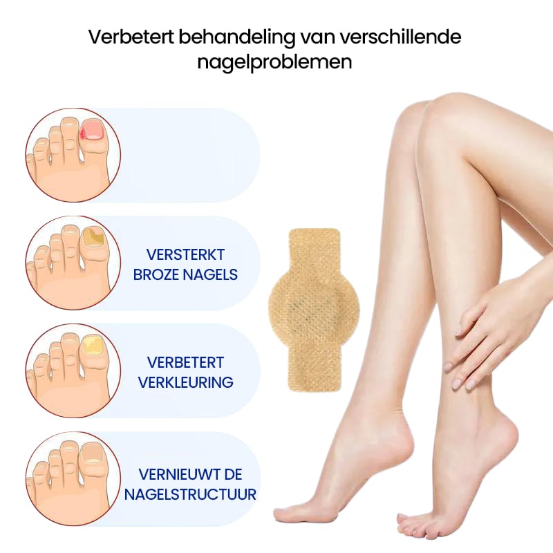 Schimmelnagelplekken