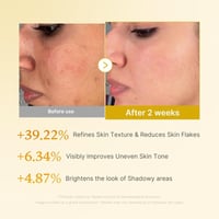 Kojic Acid Turmeric Toner for Face & Body