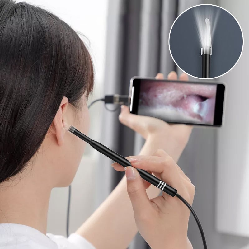 Luminescent Smart Earwax Removal Endoscope