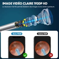 Kit d'épilation des oreilles avec caméra HD, Endoscope auriculaire avec lumières LED