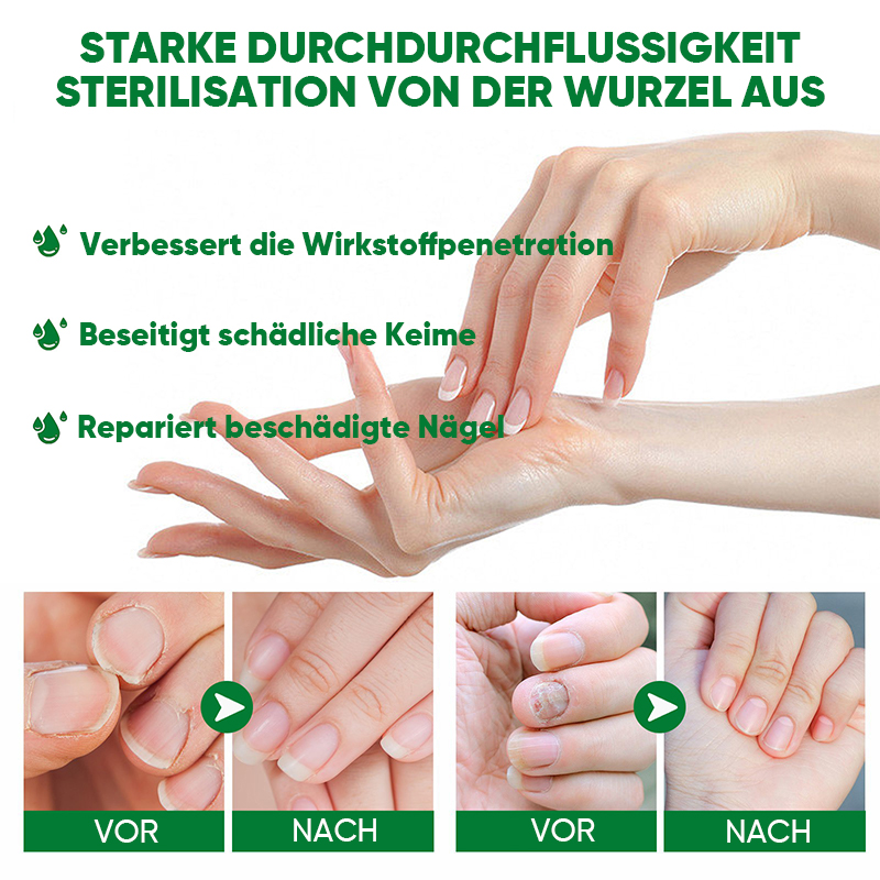 Ingwer-Nagelbehandlung
