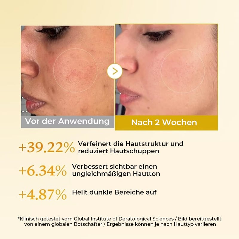 Kojisäure-Kurkuma-Toner für Gesicht und Körper