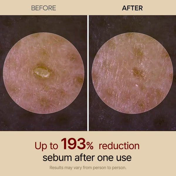 Rice Exfoliating Softening Essence