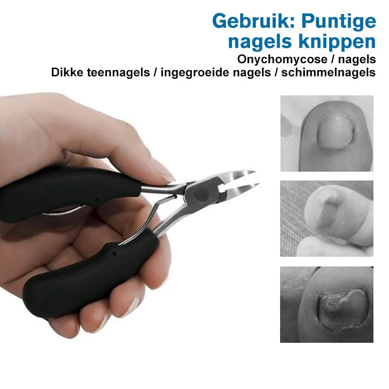 304 roestvrijstalen nagelknipperset, preventie van paronychia, schimmelinfectie