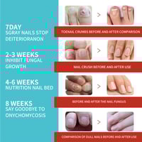 Nail Care Patches