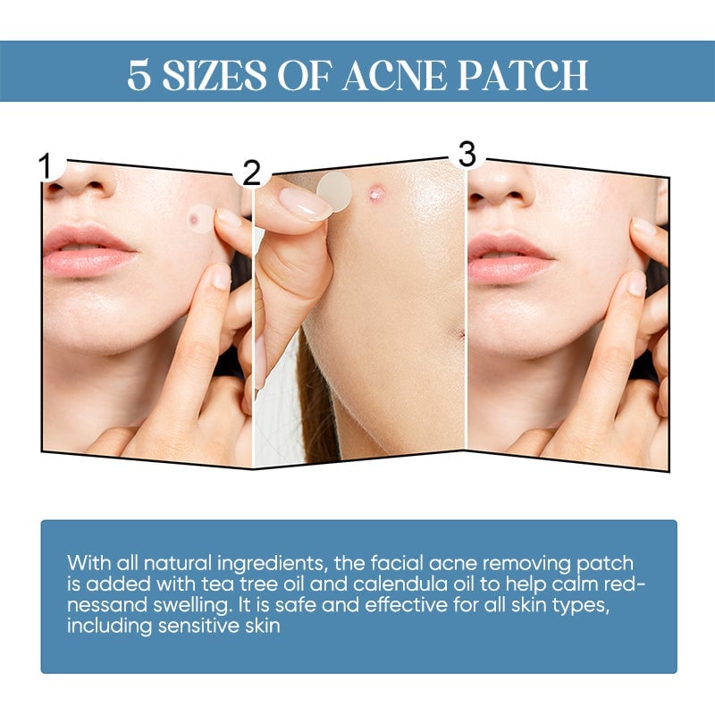 💕Acne Patches💕