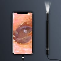 Luminescent Smart Earwax Removal Endoscope