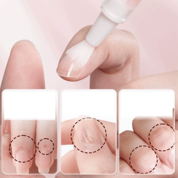 Nail Cuticle Nourishing Pen