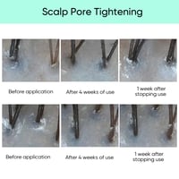 Scalp Revitalization Treatment 💡