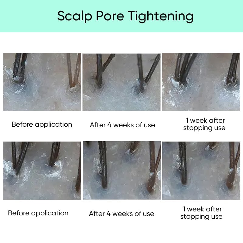 Scalp Revitalization Treatment 💡
