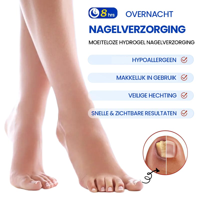 Sale - Schimmelnagelplekken