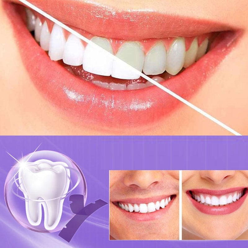 Yellow teeth whitening strips
