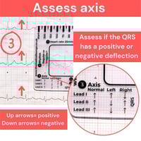 ECG 7 Step Ruler