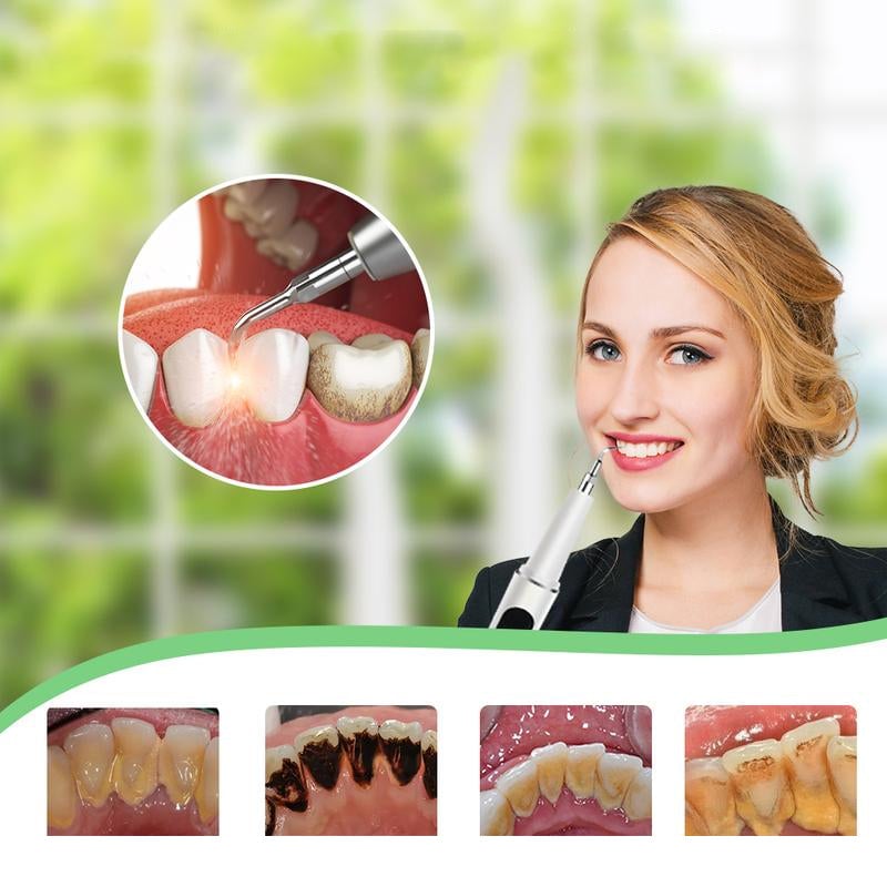 Ultrasonic Dental Cleaner