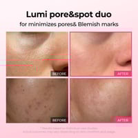 Intensive Discoloration Serum