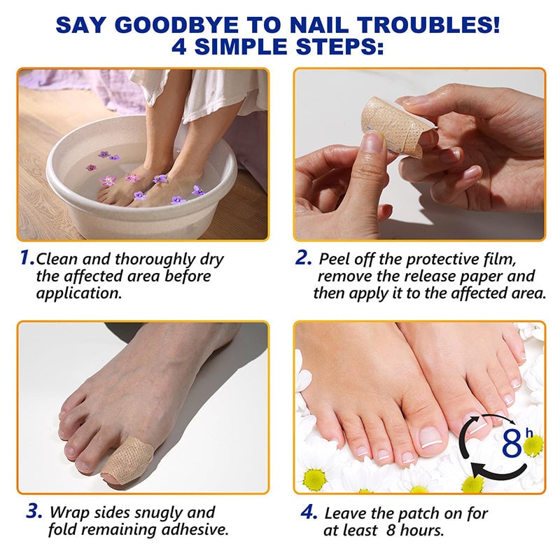 Fungal Nail Patches