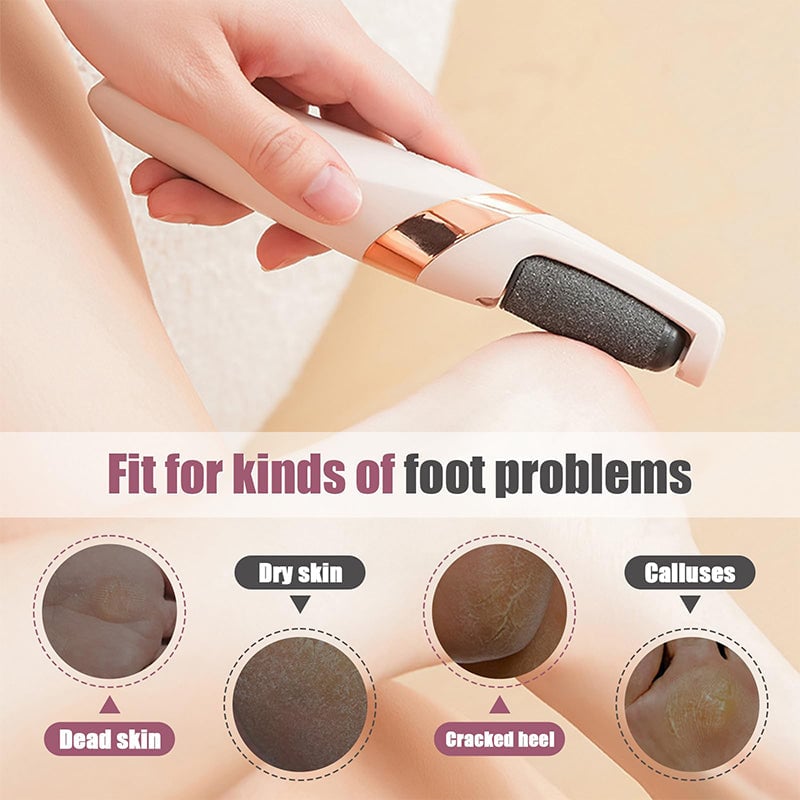 Electric Rechargeable Foot File